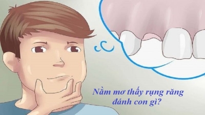 Mơ thấy rụng răng mang lại điềm gì? Nên đánh số nào ?